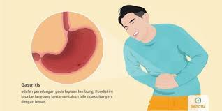 We did not find results for: Gastritis Tanda Dan Gejala Penyebab Cara Mengobati Cara Mencegah