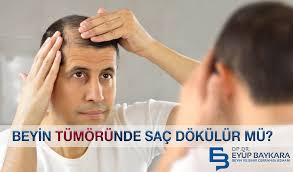 Beyin Tumorunde Sac Dokulur Mu