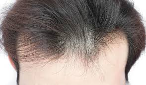 Passion flower beauty no, don't peel that sunburn — here's why. 15 Best Men S Hair Products For Thin Hair That Work Great 2021