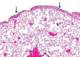 A layer of specialized cells called mesothelial cells lines the inside of your chest, your abdomen, and the space around your . Mesothelial Hyperplasia An Overview Sciencedirect Topics