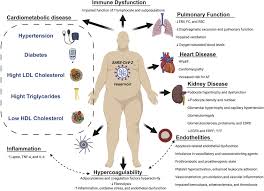 Signs and symptoms of sarcoma include: Obesity And Outcomes In Covid 19 When An Epidemic And Pandemic Collide Mayo Clinic Proceedings