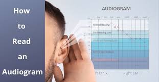 Maybe you would like to learn more about one of these? How To Read An Audiogram Absolute Audio