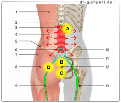 Lws Syndrom
