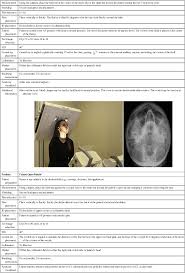 Sigma factors can be activated in response to different environmental conditions. Radiographic Positioning Radiology Key