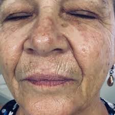 Rita Prado Estética,Terapia quantica & Iridologia