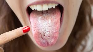 Dentist reveals why you sometimes wake up with gross taste in your mouth