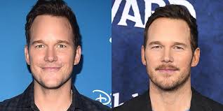 There may be a beard sparseness on the human face, and a beard may not grow due to wounds or burns on the face. 40 Hot Celebrities With Beards Best Before And After Celebrity Facial Hair Looks