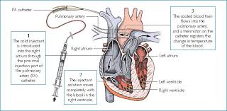 Image result for Cardiac Output