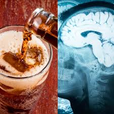 Diet Soda Literally Shrinks Your Brain Is Tied To Dementia Diet Soda Bad Health And Nutrition Dementia