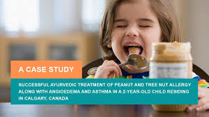 2-Year-Old Child from Canada Recovered from Peanut Allergy, Tree Nut  Allergy, Angioedema and Asthma -