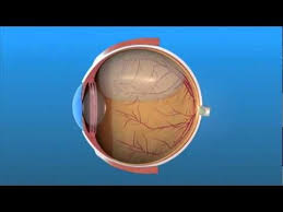 Video Explanation Of The Gas Bubble Bubbles Human Body Detachment