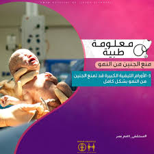 معلومة طبية يمكن إزالة الورم الليفى في النصف الثاني من شهور الحمل أو أثناء الولادة 27 من النساء المصابات بتأخر الحمل لديهم أورام ليفية رحمية 50 من الن