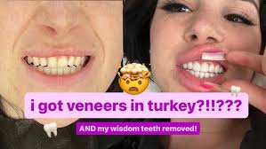 😁 WE GOT OUR TEETH DONE! VLOG