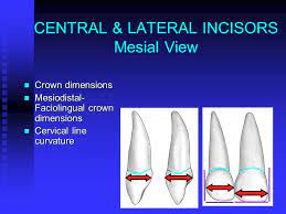 Md diameter of the crown: Principal Morphologic Comparisons Those Morphologic Features Used To Compare And Differentiate Teeth Within Each Of 2 Categories Maxillary Molars And Ppt Download