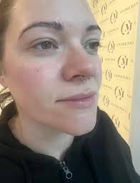 Watch our clients Polynucleotides...