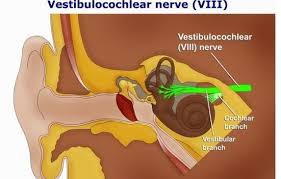Image result for Bacterial Labyrinthitis