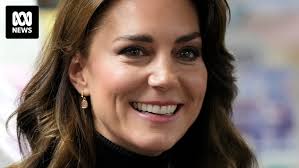Kate Middleton Teeth: What Has Duchess Of Cambridge Done To Her Smile? |  Hello!