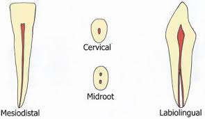 Or less, the measurements were averaged. Permanent Maxillary And Mandibular Incisors Intechopen