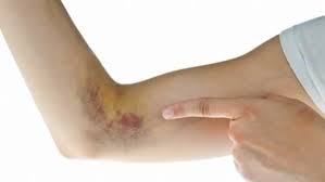 Kolda Morarma Nedenleri Morarma Com