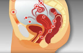 We did not find results for: Vaak Last Van Buikpijn Deze Tekenen Wijzen Erop Dat Je Misschien Endometriose Hebt