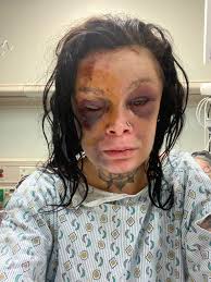 Fundraiser by Ashley Yinger : Domestic violence need help with bills while  in icu