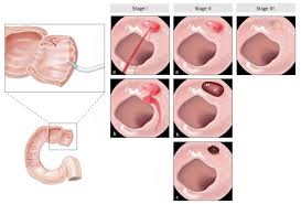 You can donate via venmo or cash app to support this channel (thanks!): Gastrointestinal Bleeding Amboss