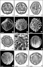 Image result for Paropsia brazzeana