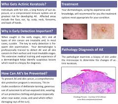 Left untreated, some actinic keratoses (aks) turn into a type of skin cancer called squamous cell carcinoma. Actinic Keratosis Incyte Diagnostics Blog