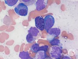 Image result for Mast Cell