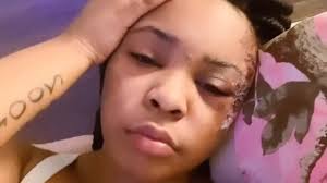 20-year-old woman recovering after Hampton hit-and-run, police searching  for suspect vehicle