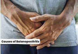 Image result for balanoposthitis