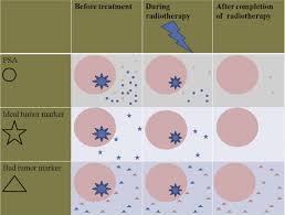 Since 1999 we have successfully implanted gold markers in 705 patients. Markers Of Toxicity And Response To Radiation Therapy In Patients With Prostate Cancer Advances In Radiation Oncology