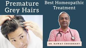 Hair loss is a frequently caused side effect of drugs but hair color is another adverse effect that is rare but bothersome. Grey White Hairs Premature Grey Hairs à¤¸à¤« à¤¦ à¤¬ à¤² Yash Homeopathic Center Youtube