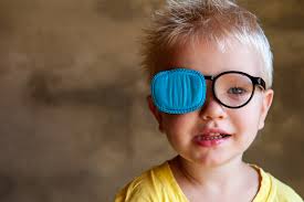 According to the national eye institutes', national eye health education program, low vision is defined as a visual impairment, not correctable by achieving the patient's low vision rehabilitation goals is accomplished by the use of prescriptive optical and electronic magnification devices as well as patient. Vision Rehabilitation Aoa