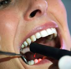 Wir müssen bei den reformen einen schritt zulegen; Umfrage Briten Ziehen Sich Die Zahne Lieber Selbst Welt