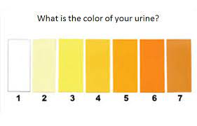 Check spelling or type a new query. Your Health And Urine 8 Different Types Step To Health