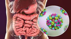 We did not find results for: Norovirus Symptome Behandlung Und Verlauf Focus Arztsuche