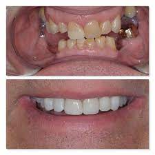A top dentist opens up about what he wishes his patients would do. Cosmetic Dentist Digital Dental Treatments Leeds