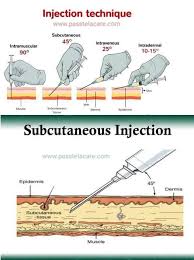 Complete Idea About All Type Of Injection And Technique Nursing School Survival Medical Education Nursing School Notes