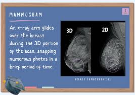 Image result for Mammogram Interpretation