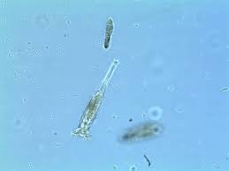 Water garden, fish pond, and/or garden pond. Euplotes Nc Museum Of Natural Sciences Education Blog