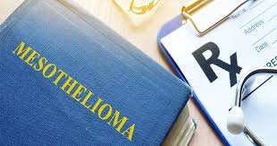 Learn more about top treatment options in our free guide. Why Is It Important To Hire A Lawyer After A Mesothelioma Diagnosis