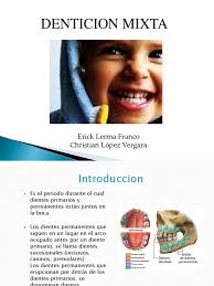 Denticion Mixta Erick