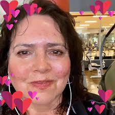 How to cope with a multiple sclerosis diagnosis?