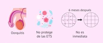¿sabías que un varón que tiene la vasectomía puede nuevamente ser fértil? La Vasectomia Efectividad Complicaciones Y Cuidados Posteriores