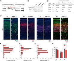 Gcap14 is a microtubule plus-end-tracking protein coordinating  microtubule–actin crosstalk during neurodevelopment | PNAS