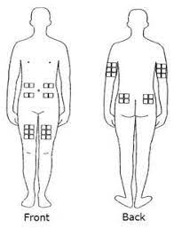 Rebif Fda Prescribing Information Side Effects And Uses Multiple Sclerosis Nursing Care Side Effects