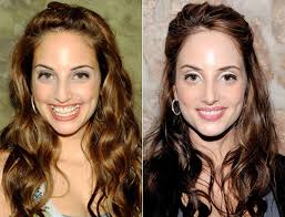 Now, cosmetic and reconstructive procedures are quite common, and many do not even require invasive measures. Alexa Ray Joel Debuts New Nose Weeks After Having Plastic Surgery New York Daily News