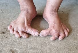 The old lady has strange feet, similar ...