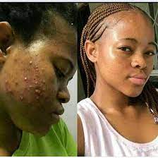 Their skin care products line involves cleansers toner serum products for the eyes scrub mask moisturizers herbalife skin on twitter get rid of black spots blemishes and. Theaimistochangepeopleslives Hashtag On Twitter